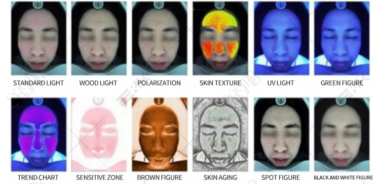 Skin Scanner Facial Skin Analyzer Skin Smart Diagnostic Device AI Facial Skin Detection Machine 5