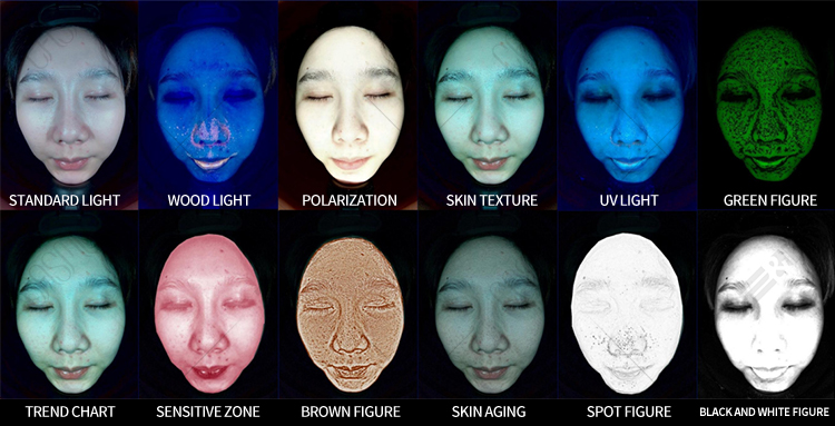Skin Scanner Facial Skin Analyzer Skin Smart Diagnostic Device AI Facial Skin Detection Machine 6