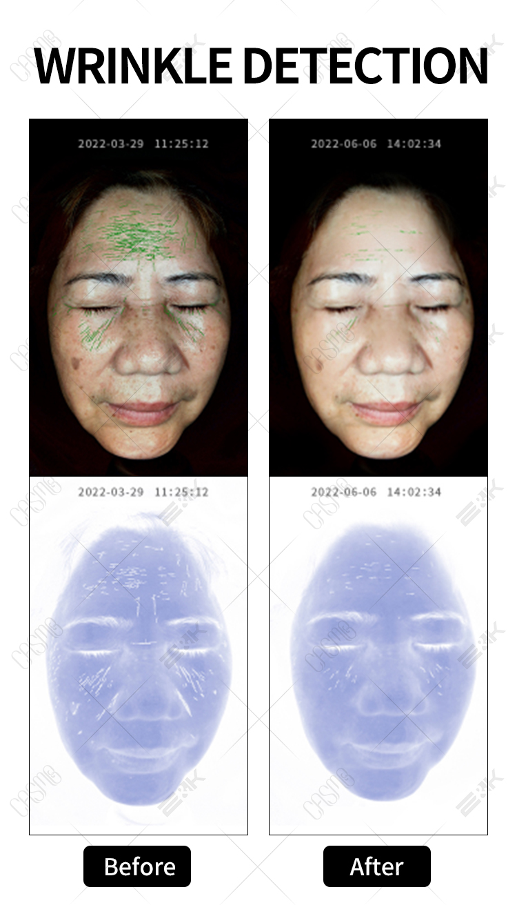 Skin Scanner Facial Skin Analyzer Skin Smart Diagnostic Device AI Facial Skin Detection Machine 7