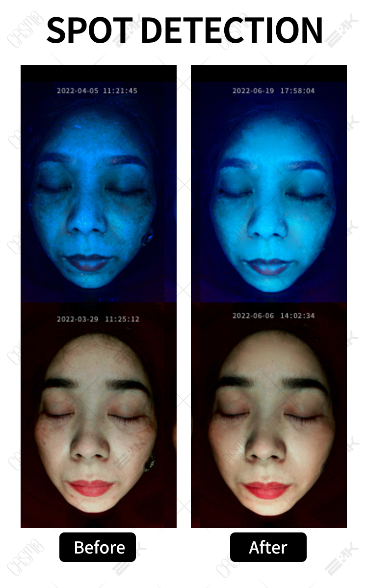 Skin Scanner Facial Skin Analyzer Skin Smart Diagnostic Device AI Facial Skin Detection Machine 8
